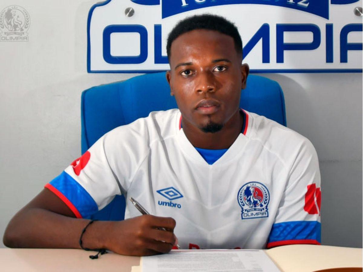 Exfutbolista de Olimpia cuenta su impactante historia: “Psicológicamente me hacían daño”