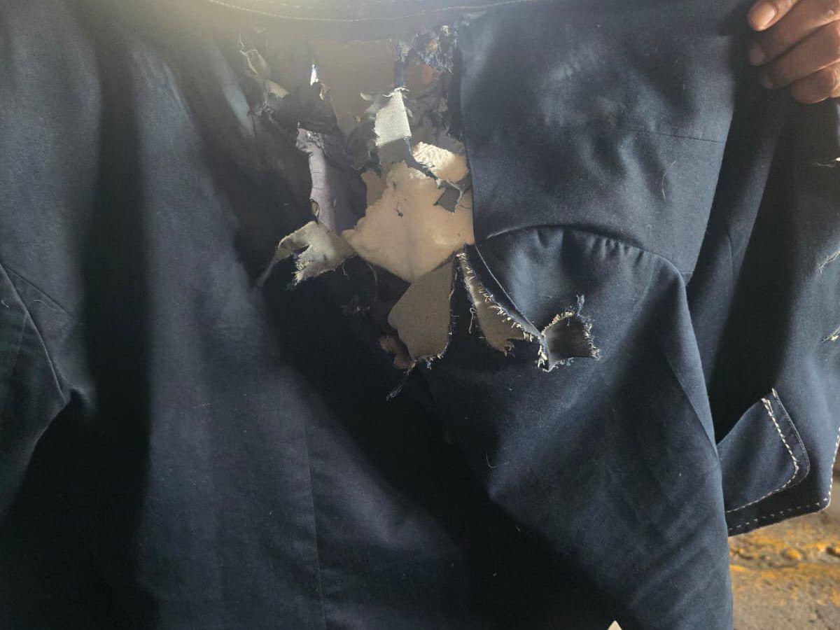 Daño auditivo y posibles quemaduras de tercer grado: estado de salud de la diputada Gladis López