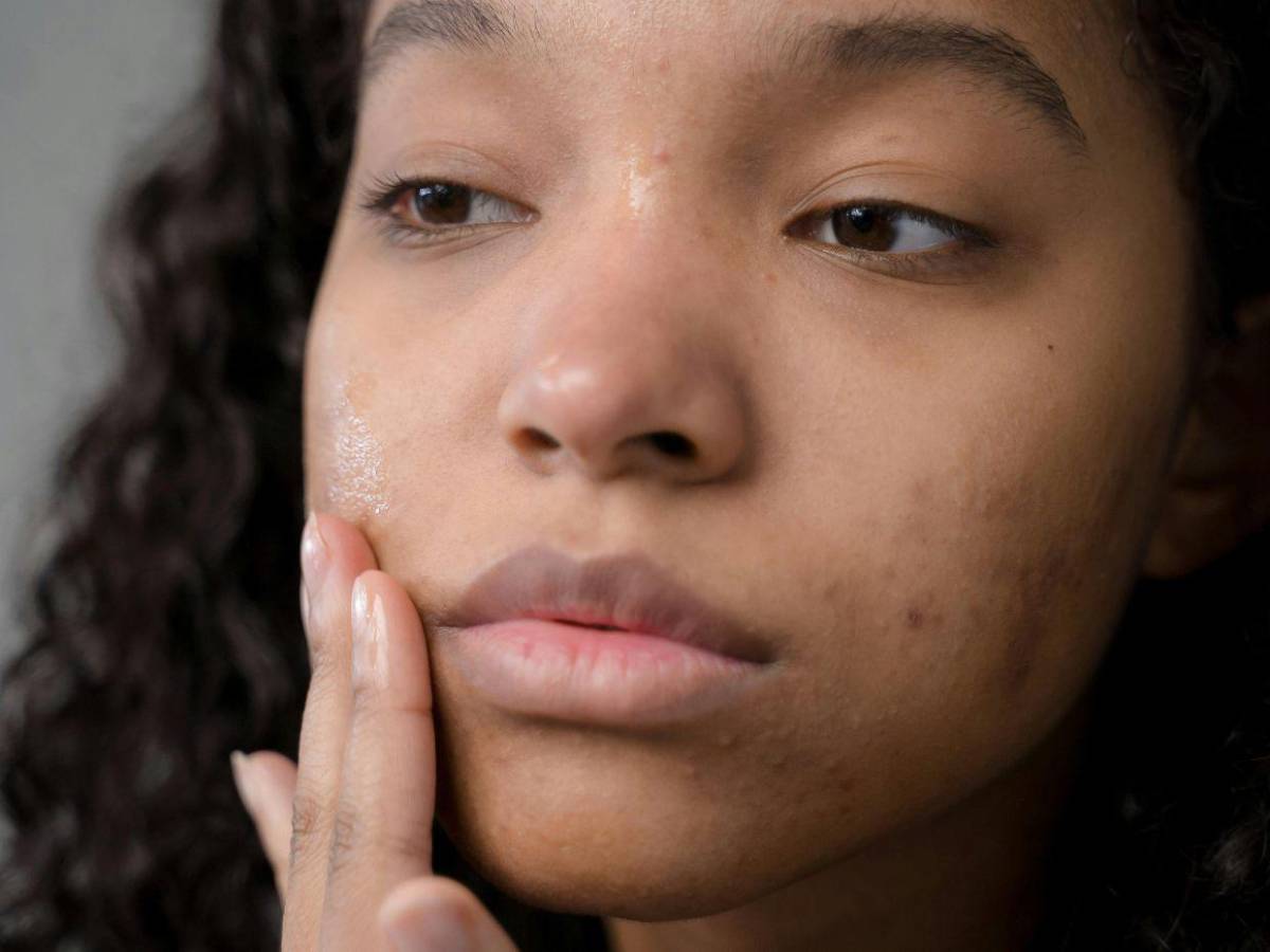Manchas, ojeras y piel apagada: la molécula que dermatólogos no quieren que ignores