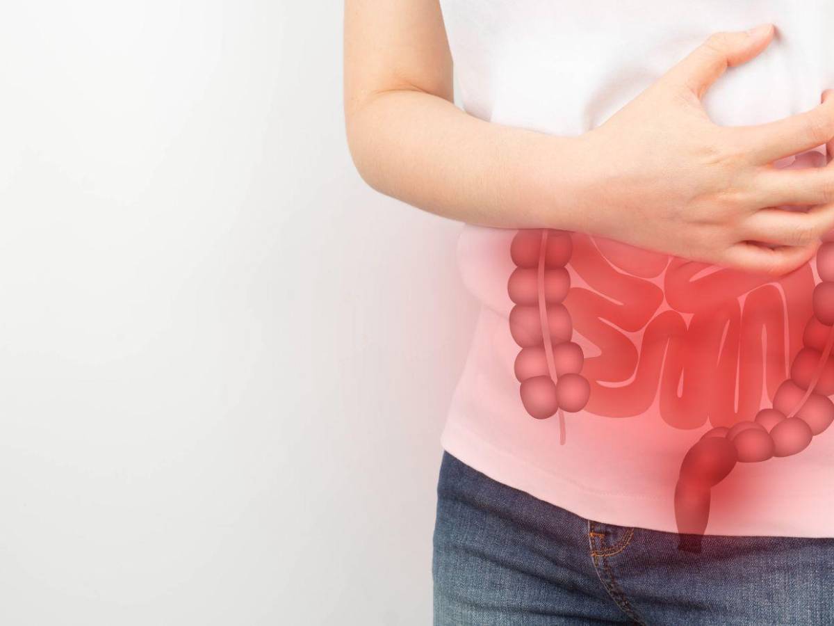 ¿Qué alimentos debes evitar para prevenir el cáncer de colon? Esto dicen expertos
