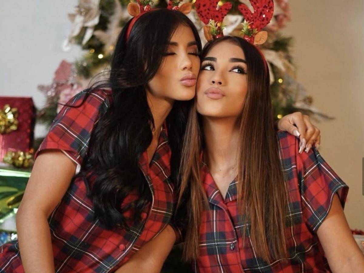 El antes y el después de la modelo Karina García: su transformación total