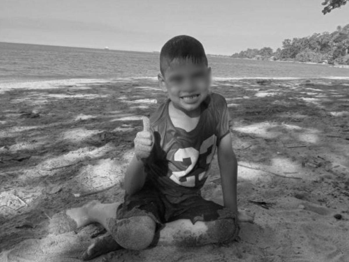 Tenía el cerebro inflamado: Eylin Serrano murió cinco días después tras un accidente en Omoa