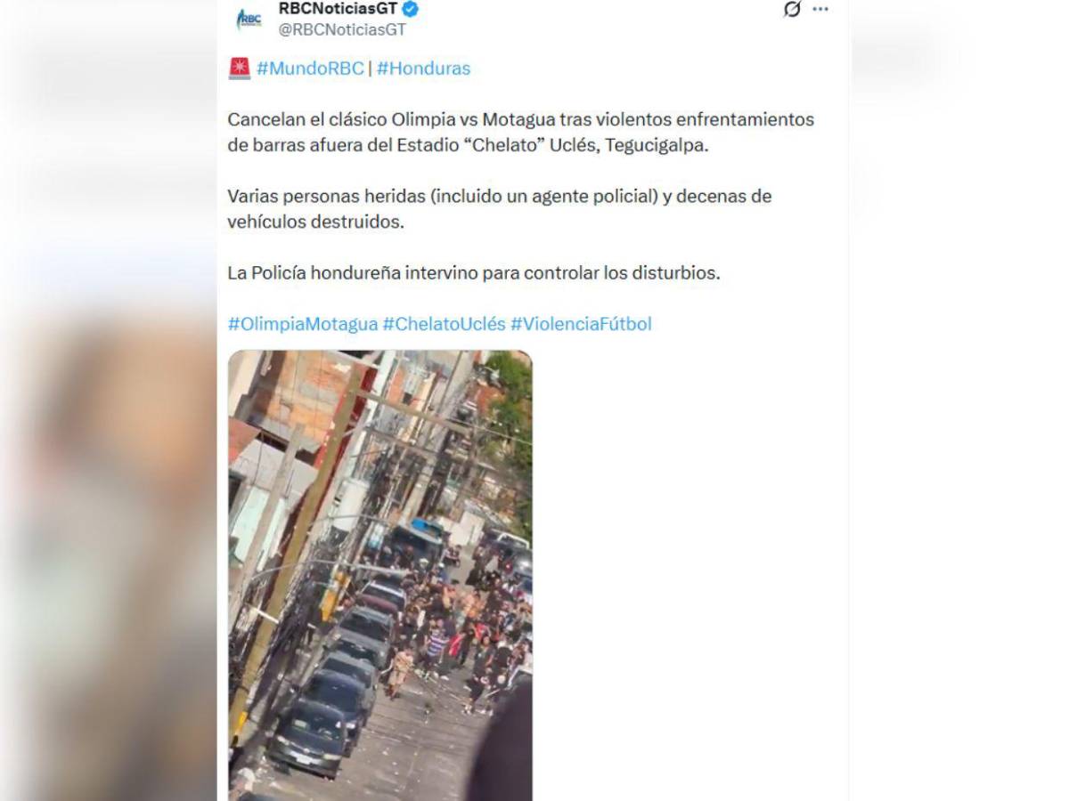 Hubo heridos y aún así se jugó: así informa el mundo sobre la violencia en el clásico