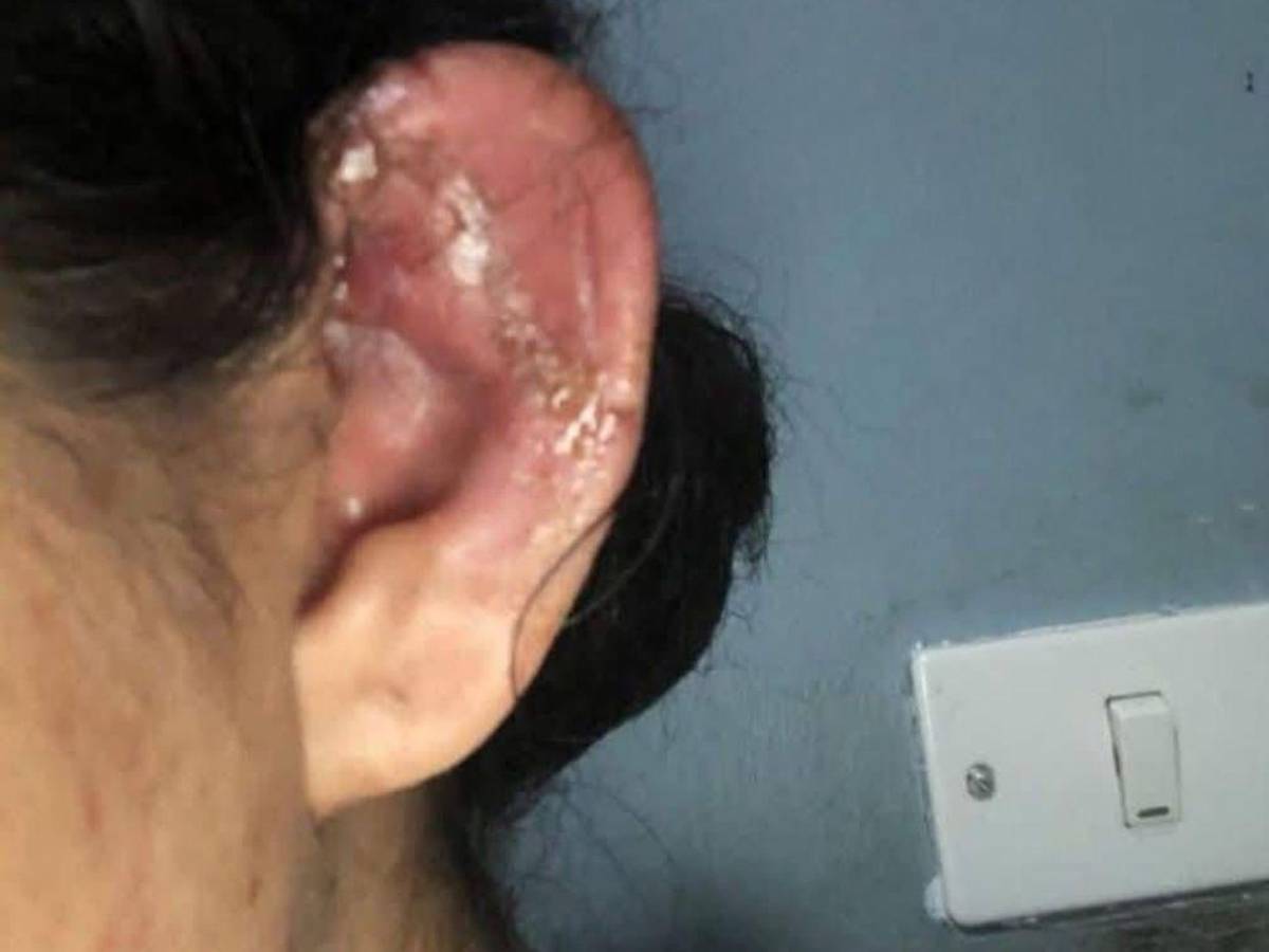 Tenía 40 días de haber parido: madre de Dayani Acosta, joven atacada a mordidas por su expareja