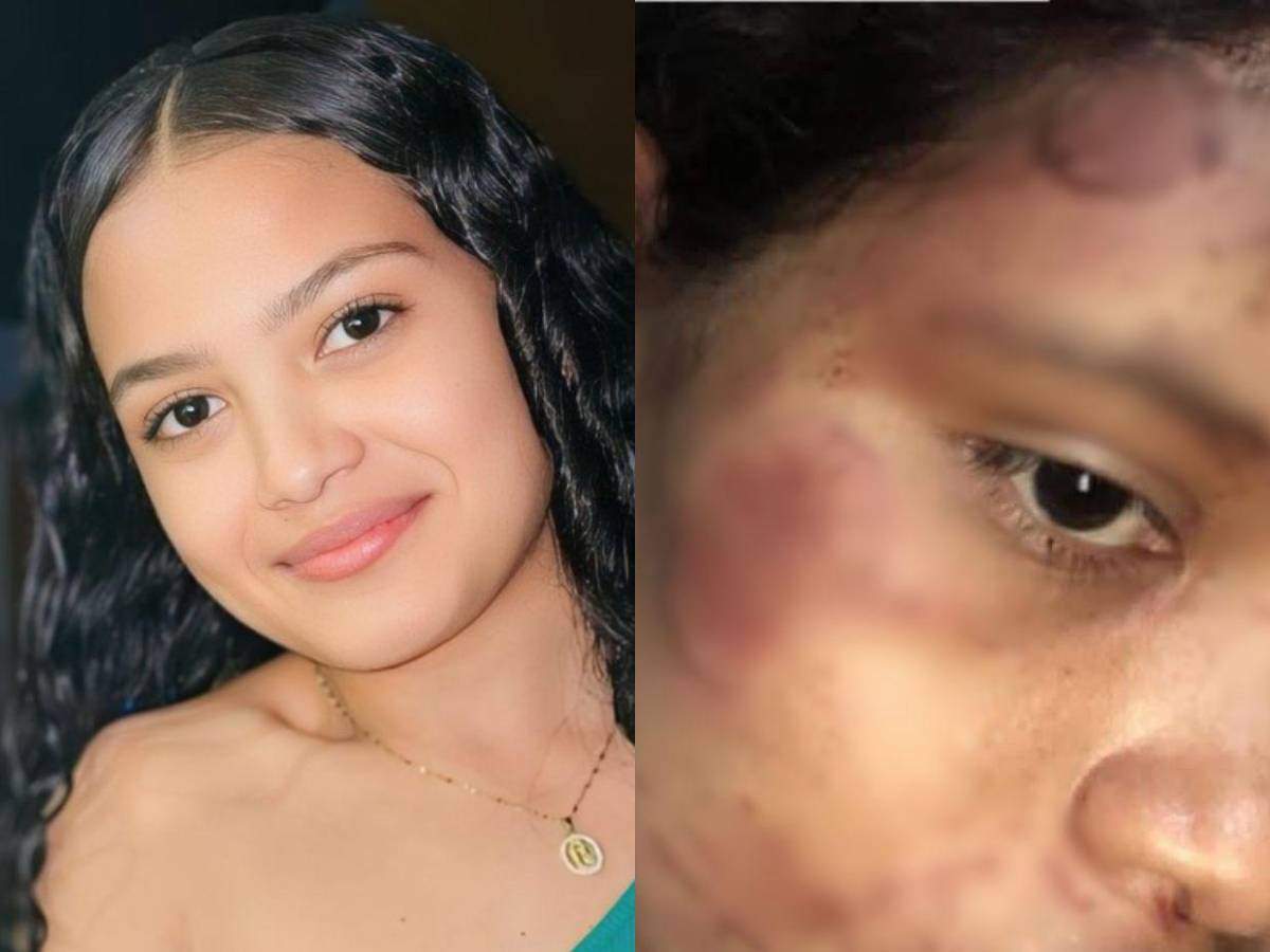 Tenía 40 días de haber parido: madre de Dayani Acosta, joven atacada a mordidas por su expareja