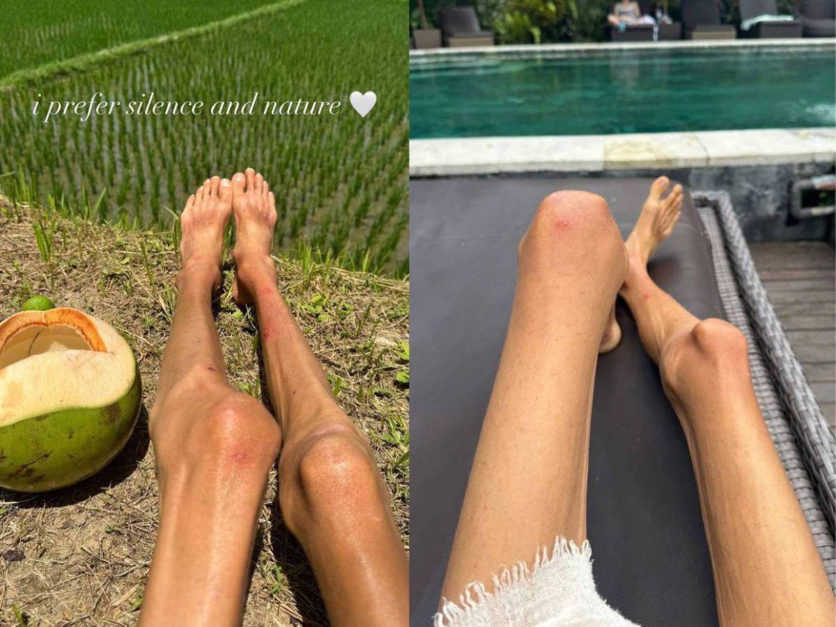 ¿Quién es Karolina, influencer que murió tras dieta basada solo en frutas en Bali?