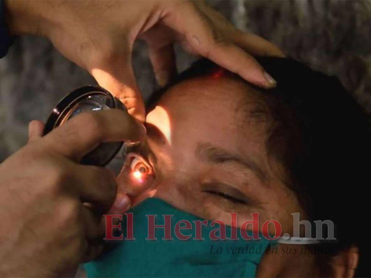 Confirman nuevo caso de hongo negro en el Hospital Escuela