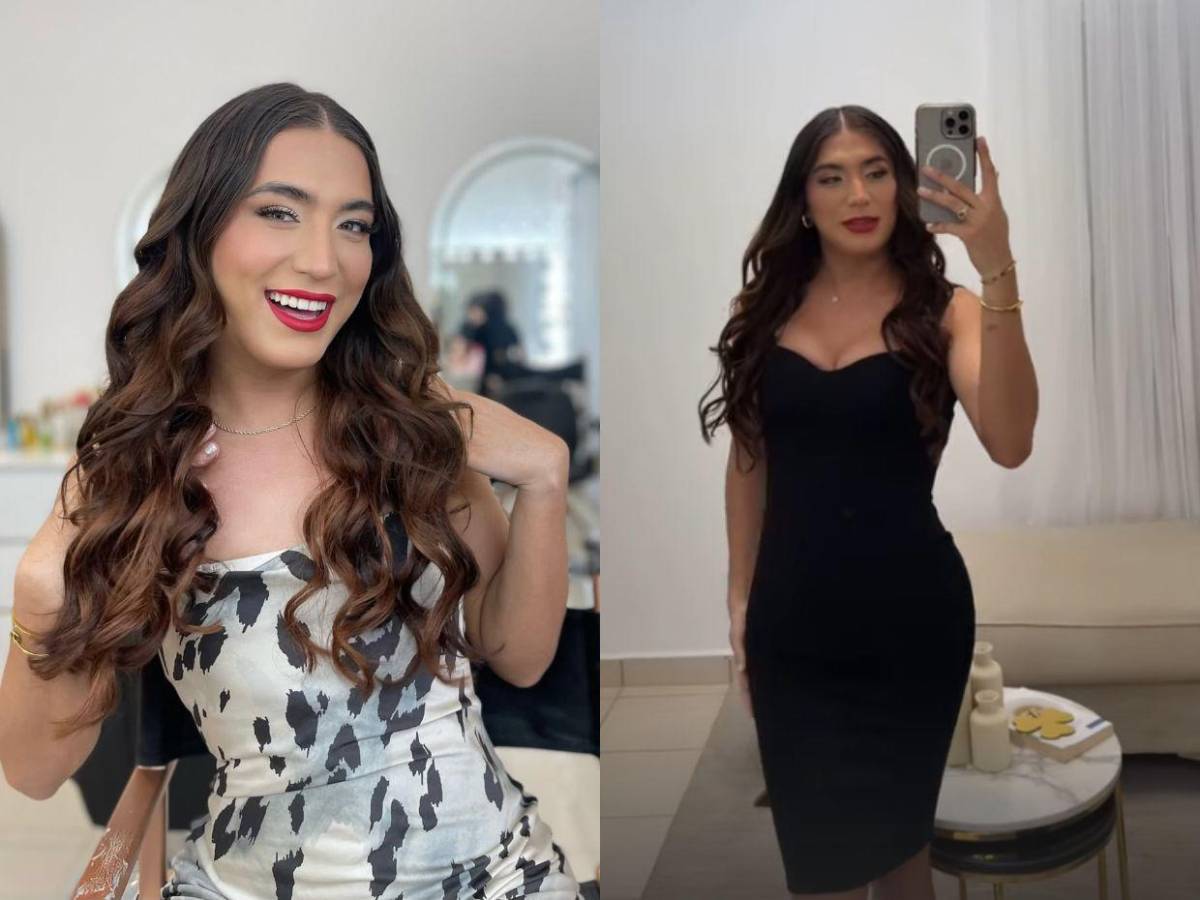La Bicha Catracha luce su nueva figura tras liposucción: Me siento espectacular La Bicha Catracha luce su nueva figura tras liposucción: Me siento espectacular