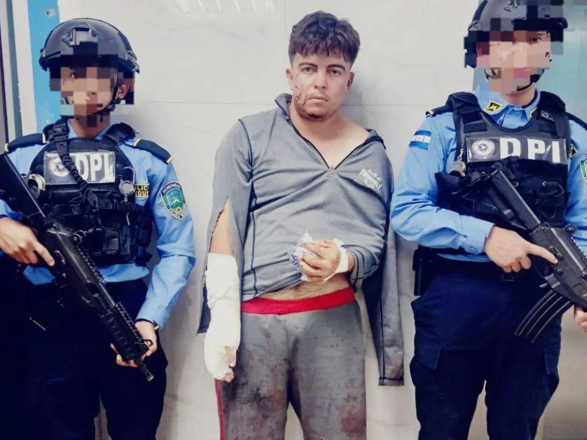 Agredió a un gato y le reclamaron: Ricardo mató a su tía e hirió a su mamá y abuela en Los Pinos