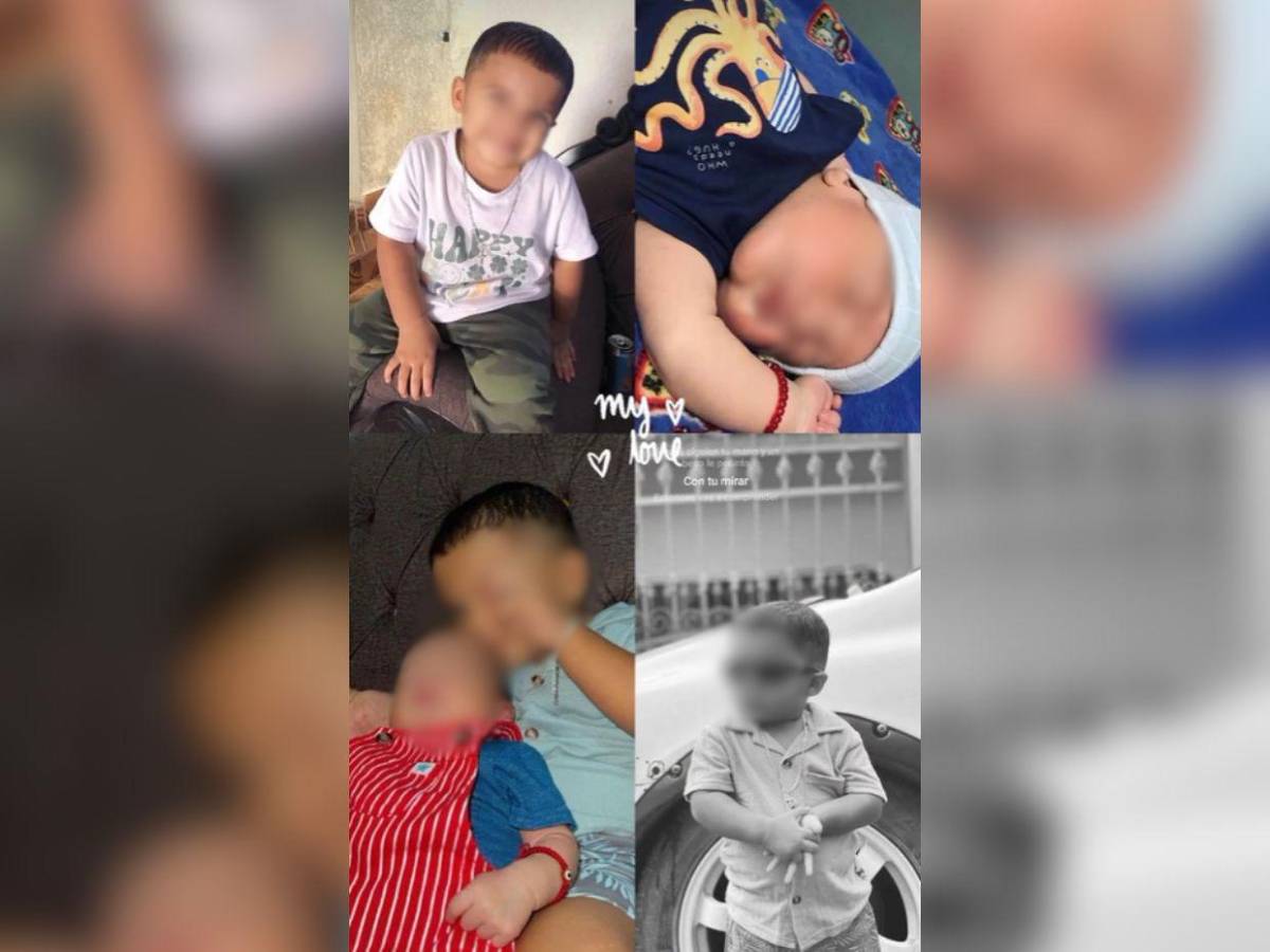 Si lo denunciaba, iba a matar a mis papás: Dayani Acosta tras ser atacada por su expareja en Olancho