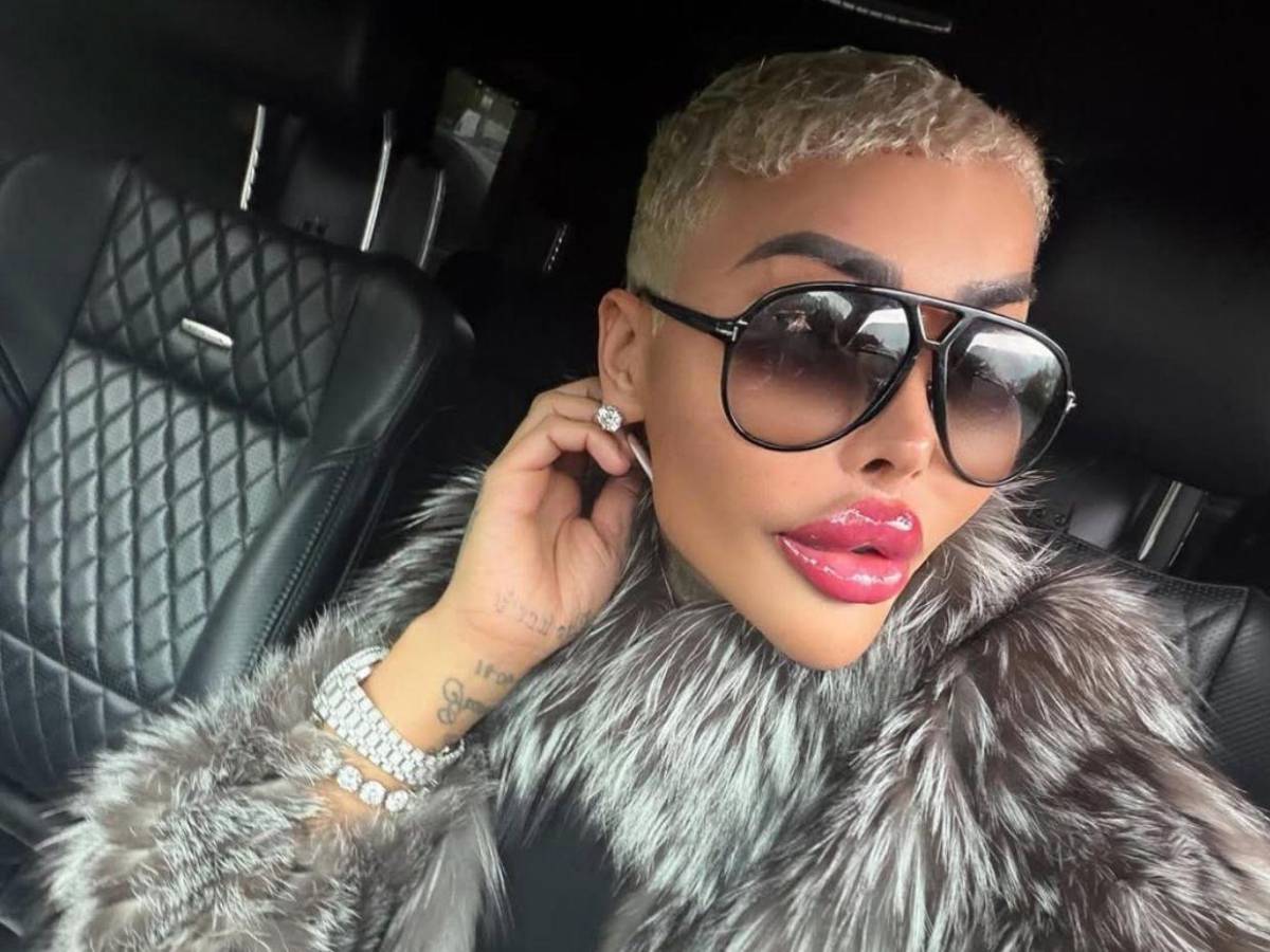 Muere el rey de los labios tras presuntas complicaciones por cirugía estética