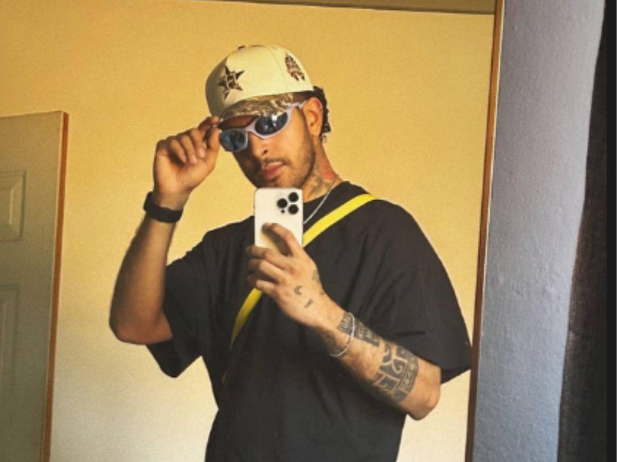 El antes y después de Fancony tras cirugía ortognática: “Soy más feliz que nunca”