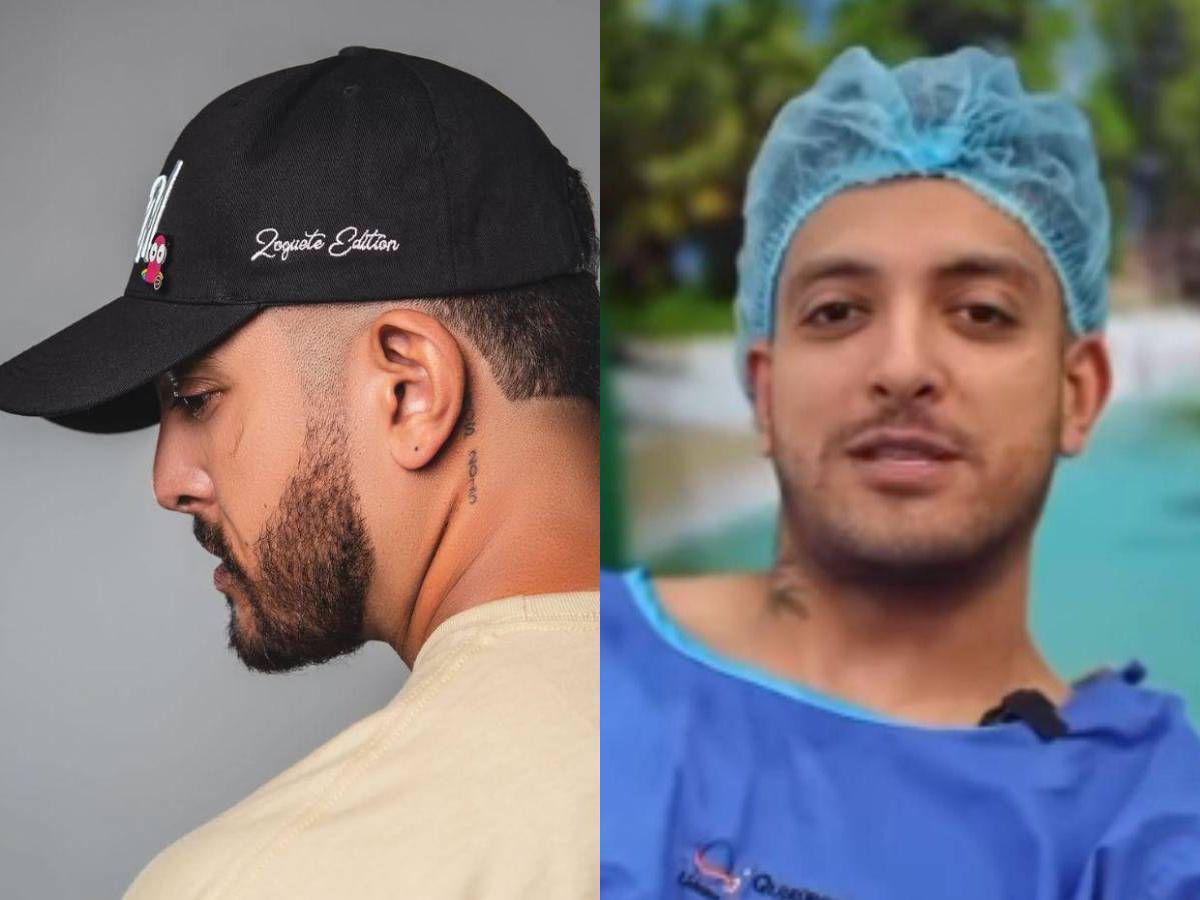 La operación que le cambió la vida: Fancony revela cuánto pagó por su transformación