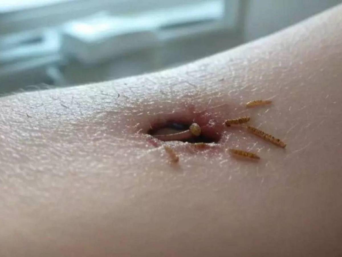 Devorador de hombres, así invade y prolifera en heridas humanas el gusano barrenador