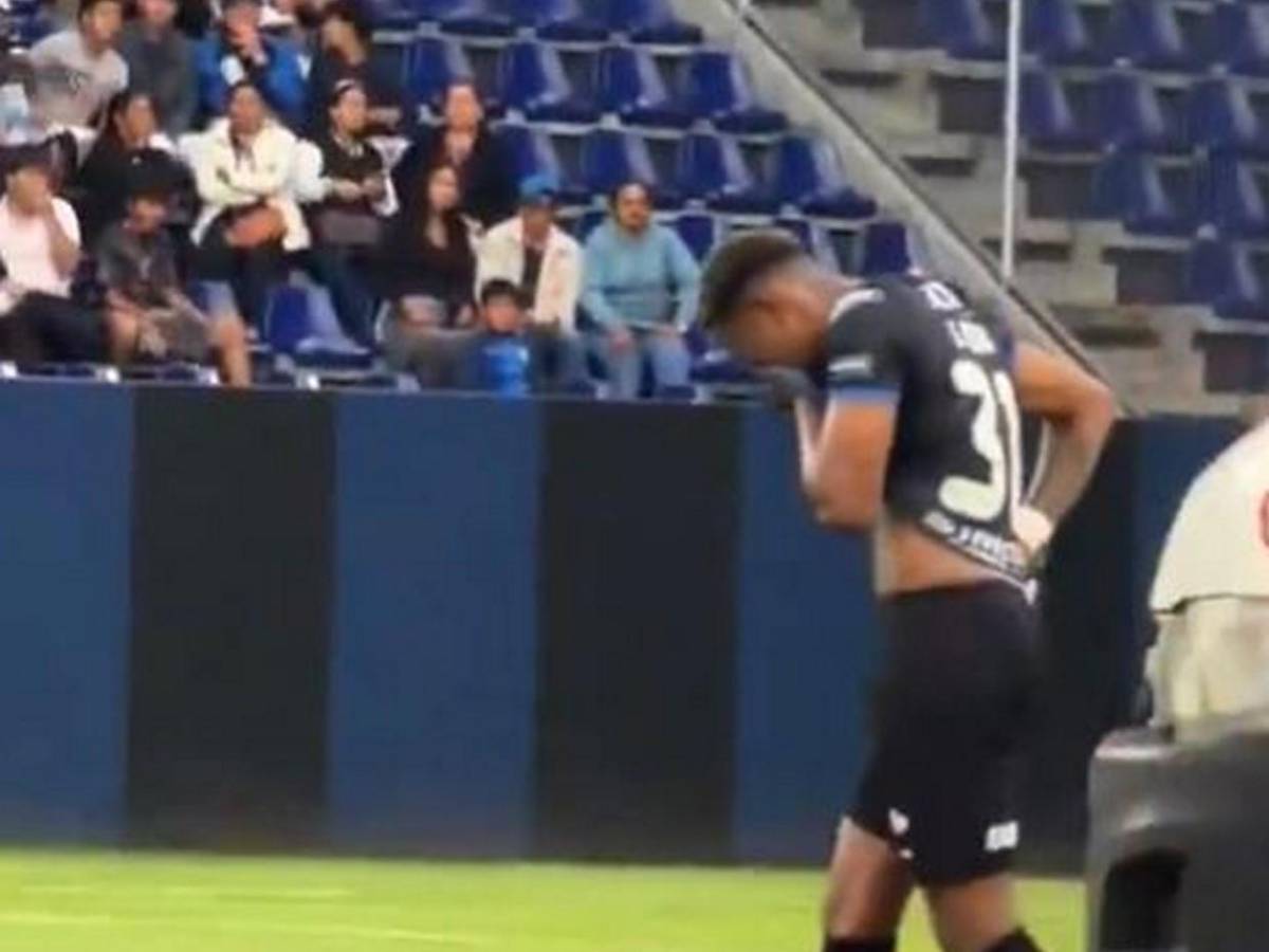 Así fue la espeluznante lesión de tobillo que sufrió Jean Pierre Arroyo