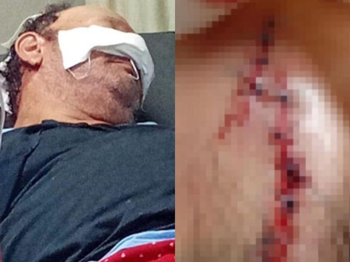 Cuadro a cuadro del ataque de un asaltante a un guardia de la tercera edad en La Ceiba