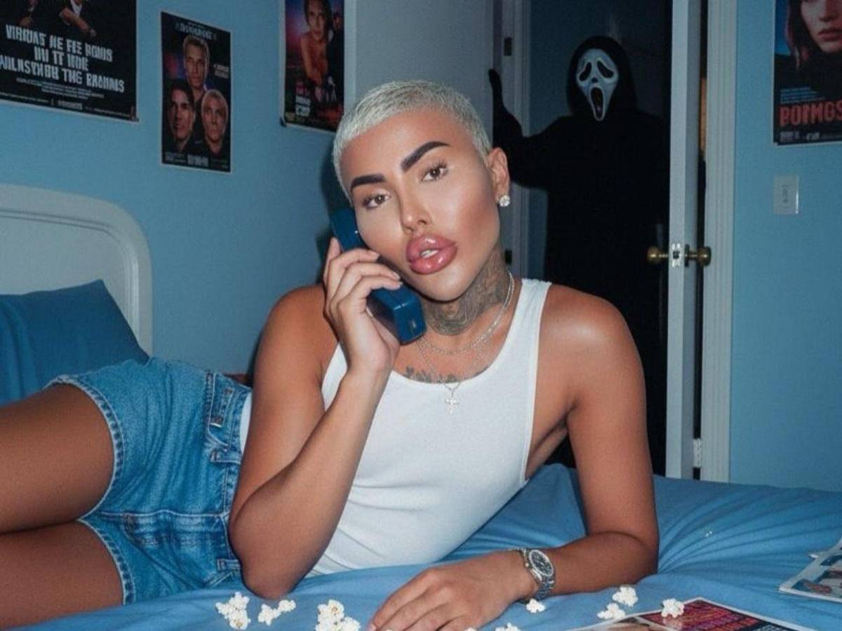 Muere el rey de los labios tras presuntas complicaciones por cirugía estética