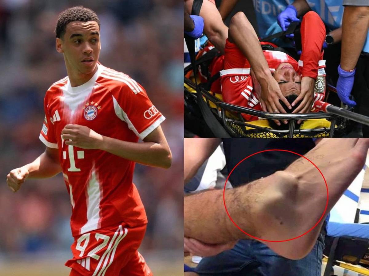 Bayern Múnich confirma la lesión de Jamal Musiala: Esta es la preocupación del club