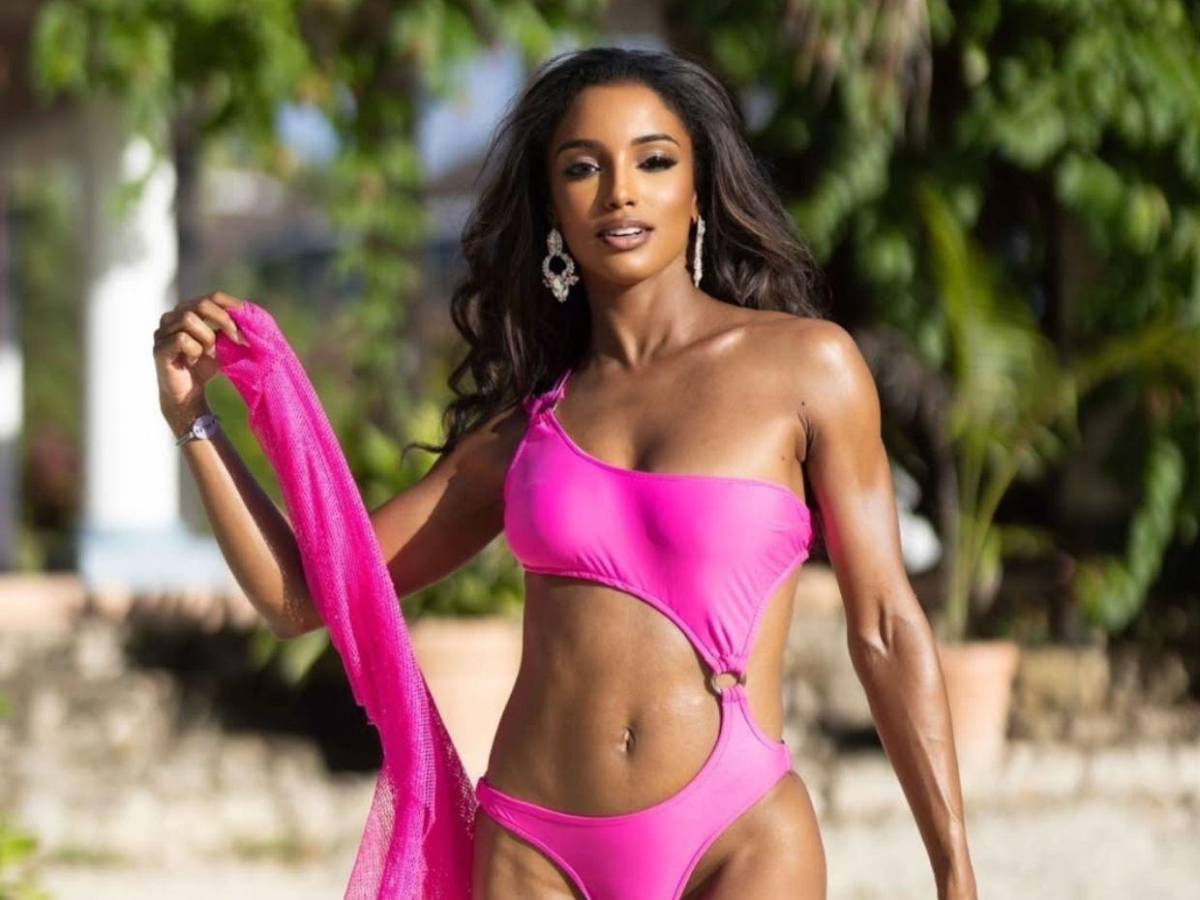 Fractura y hemorragia intracraneal: el diagnóstico de Miss Jamaica tras accidente