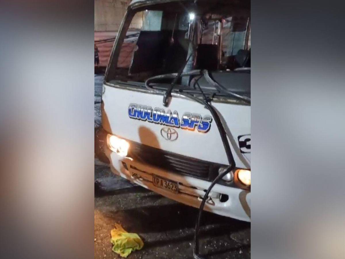 Mujer perdió la vida tras choque entre rapidito y camión en SPS; hay al menos 15 heridos