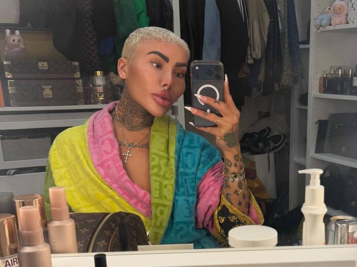 Muere el rey de los labios tras presuntas complicaciones por cirugía estética