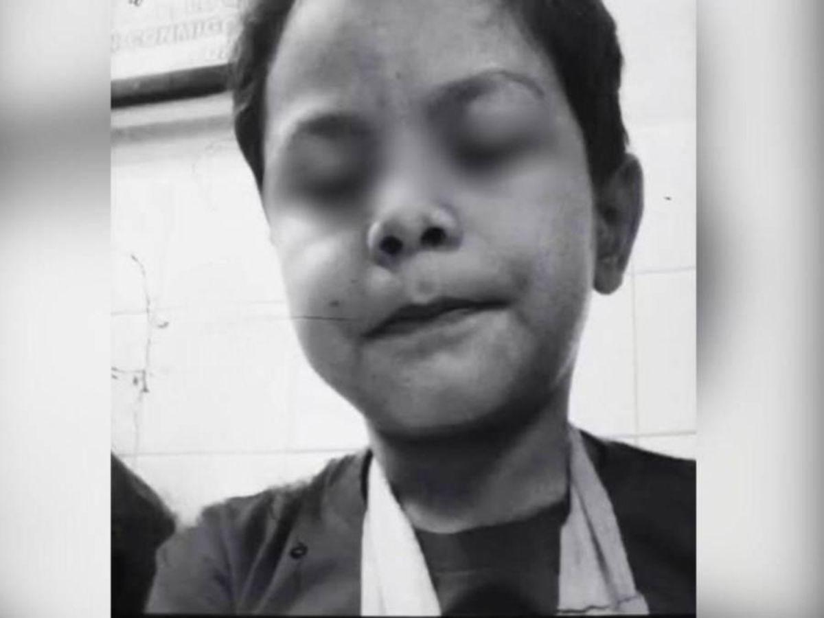 Tenía moretes y heridas en su abdomen: así hallaron a Jhonny en fábrica de El Tablón