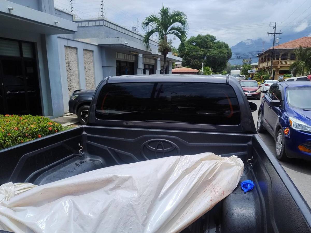 Violento ataque de perros en La Ceiba: Primero atacaron a la esposa, ahora lo matan a él: