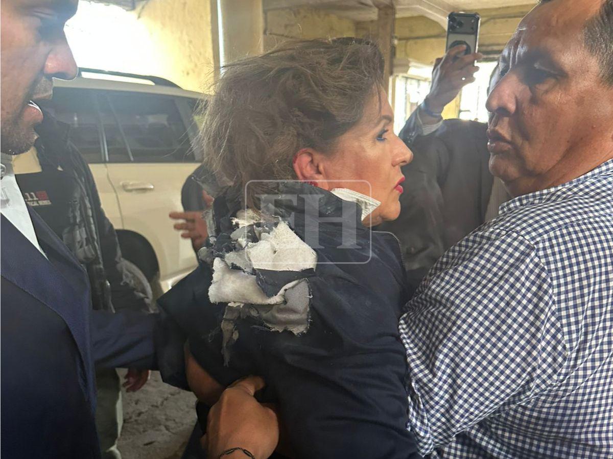 Con heridas en la espalda y cabello quemado: así quedó la diputada Gladis tras ataque con explosivo