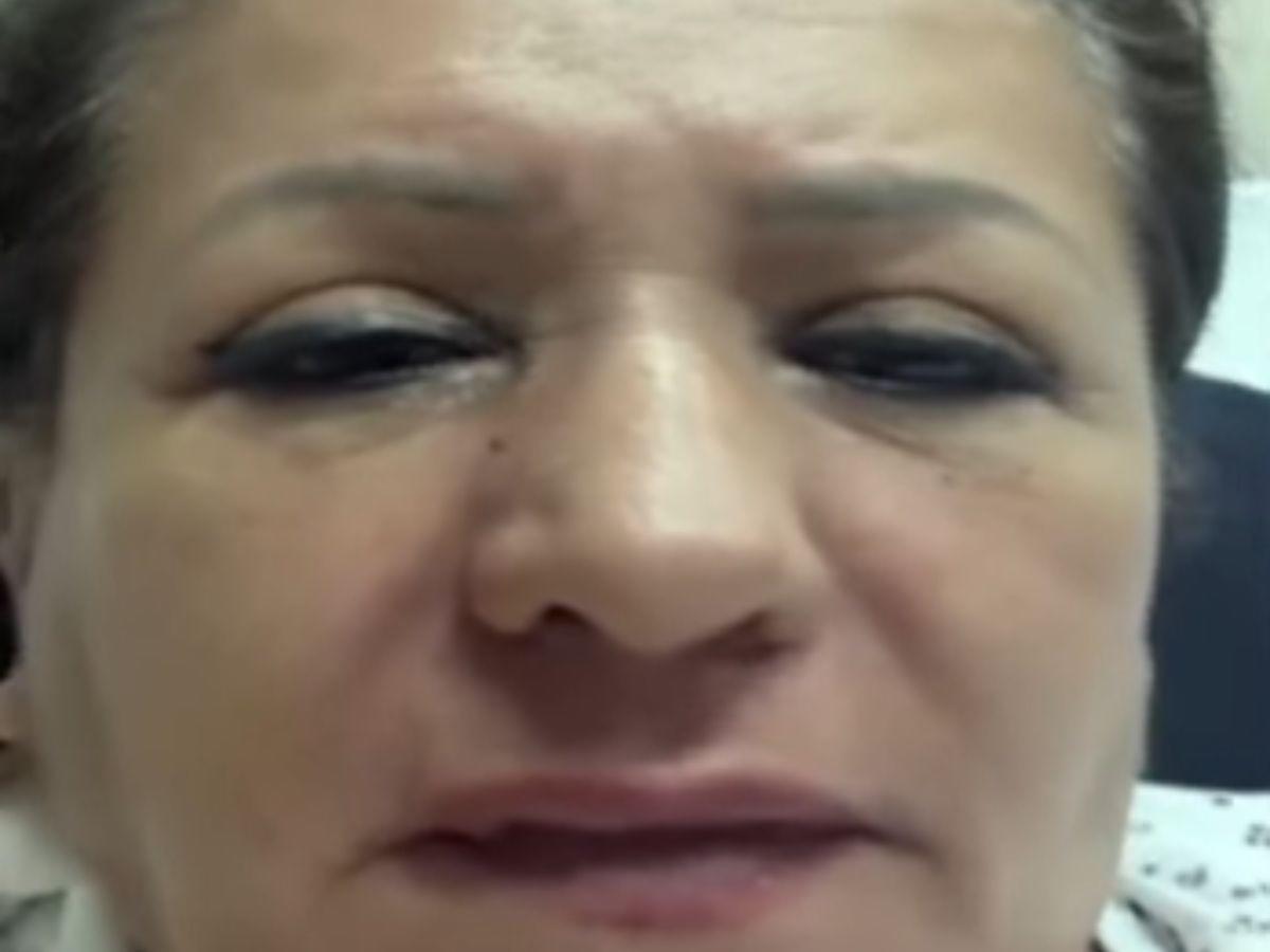 Daño auditivo y posibles quemaduras de tercer grado: estado de salud de la diputada Gladis López