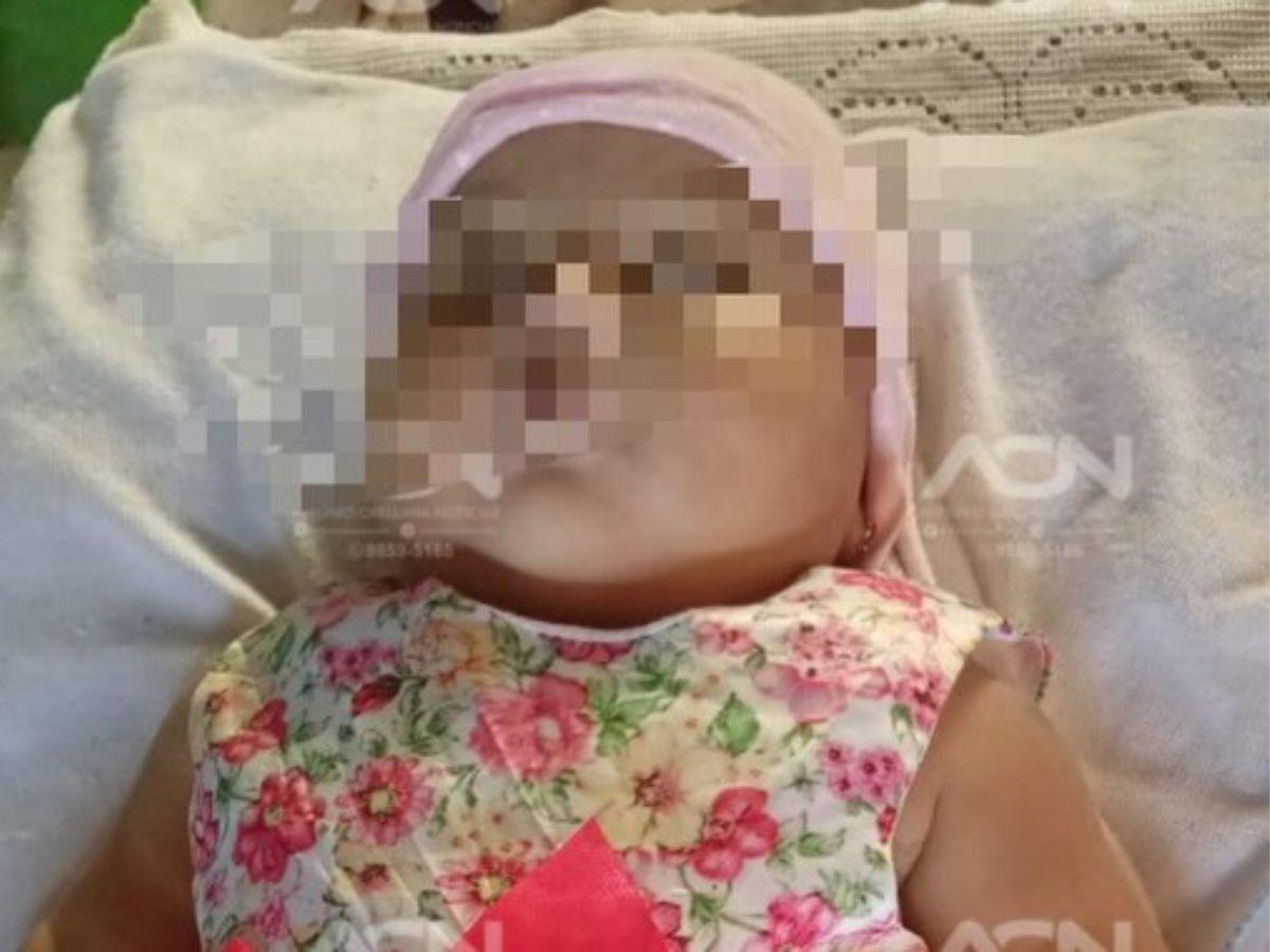 Investigan muerte de bebé de seis meses tras ser vacunada en La Ceiba: cronología del caso