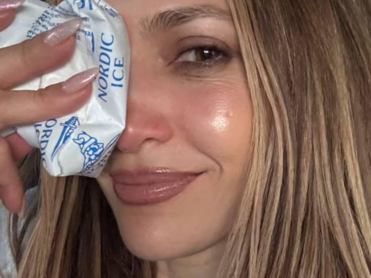 Jennifer López sufre lesión en el rostro tras un accidente en escenario