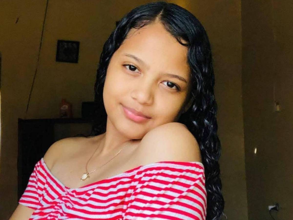 Golpes y mordidas: mujer fue salvajemente atacada por su pareja en Olancho