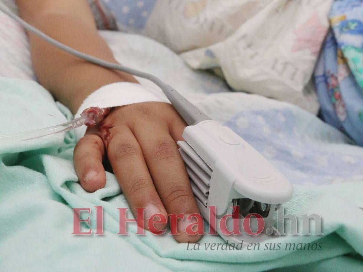 El Seguro Social reporta a 76 niños hospitalizados por dengue