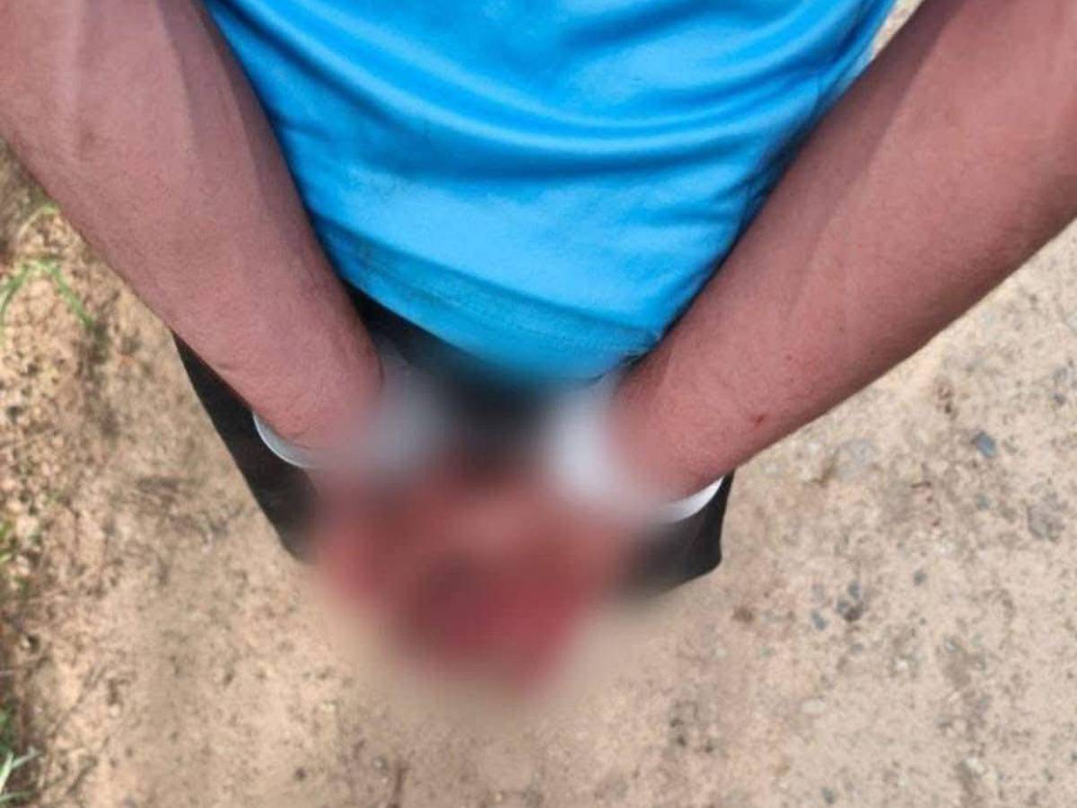 Rosa Cárcamo fue acuchillada por su sobrino tras robarle el dinero de su negocio; era madre