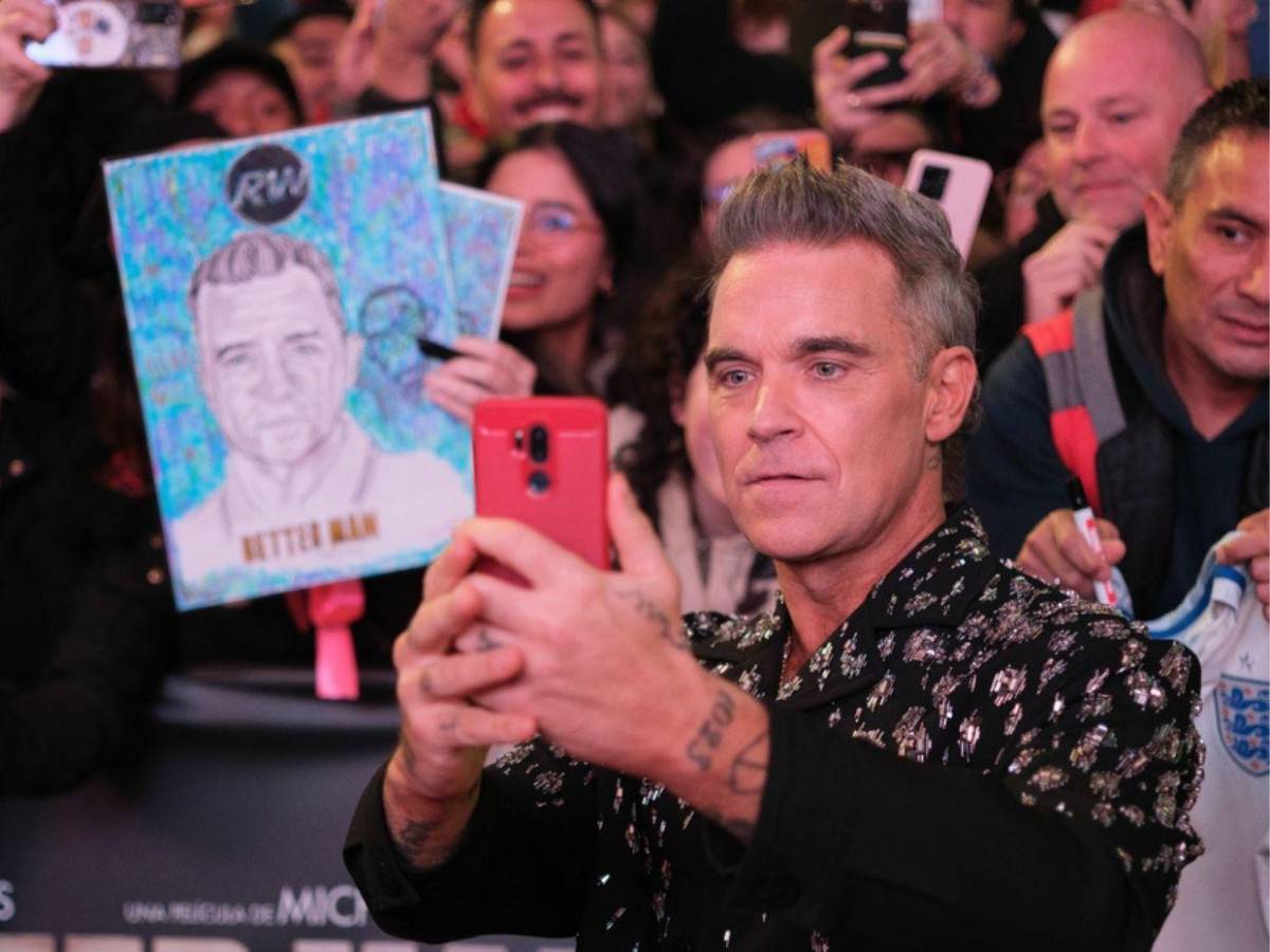 Robbie Williams revela diagnóstico de escorbuto: ¿Cómo afecta esta enfermedad?