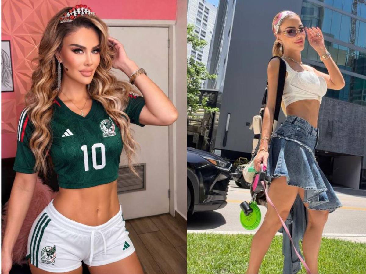 Sin filtro: Así habla Ninel Conde sobre la polémica de las cirugías