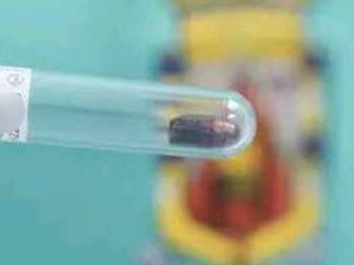 Delivery herido por 'El Burro': Me dijeron que me quedaría con la bala de recuerdo en el Catarino Rivas