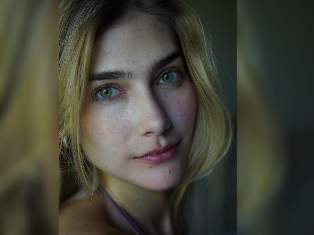 Miss Colombia, muy segura al mostrar celulitis, estrías y acné en su cuerpo