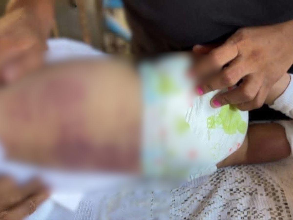 Investigan muerte de bebé de seis meses tras ser vacunada en La Ceiba: cronología del caso