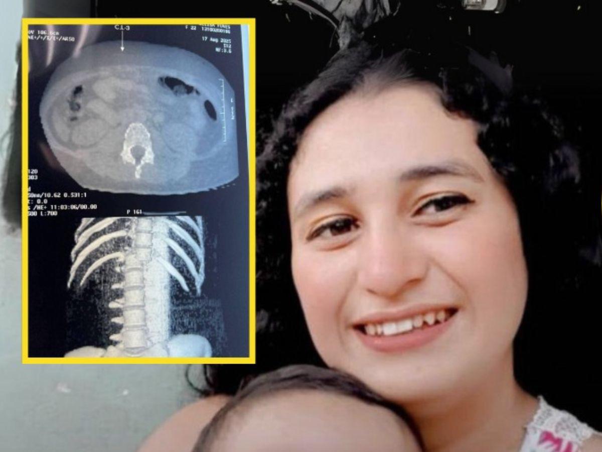 Tiene una hemorragia pulmonar: Nelsy López, la joven que se cayó de la rueda de Chicago en Copán
