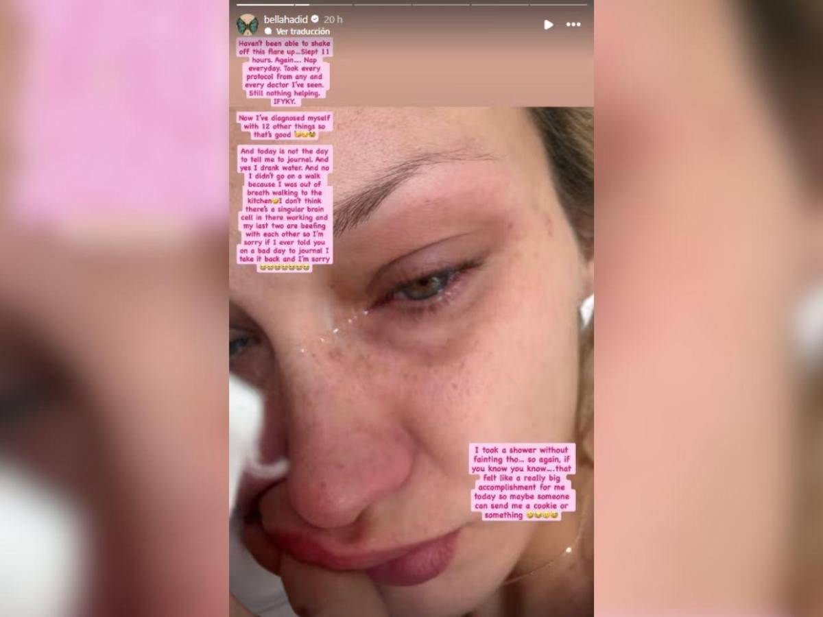 Bella Hadid, devastada por nuevo brote de Lyme: Nada me ayuda