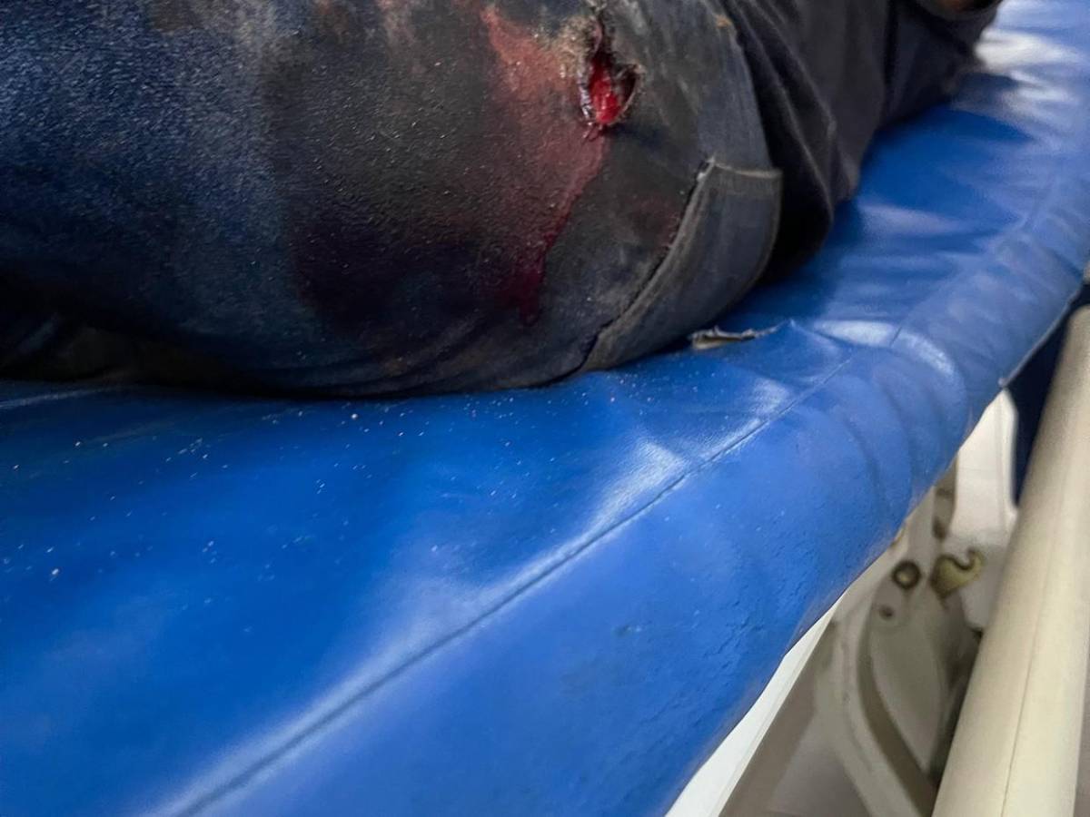 Trasladan al Hospital Escuela a 10 heridos del accidente en Villa Nueva; hay dos niños