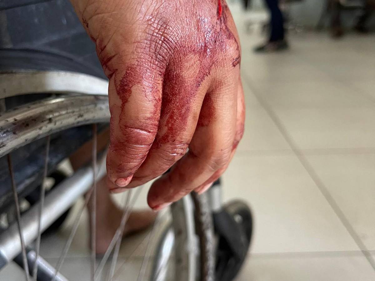 Trasladan al Hospital Escuela a 10 heridos del accidente en Villa Nueva; hay dos niños