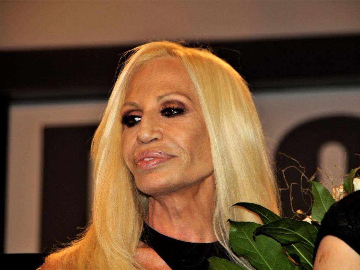 ¿Qué cambios ha hecho Donatella Versace en su rostro? Esto dicen los expertos