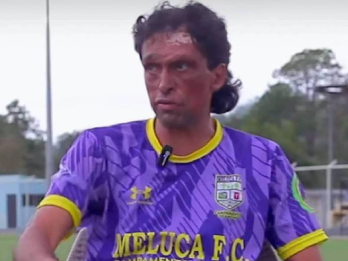 Pedro Joaquín Amador quiere ser convocado a la Selección de Honduras: Las condiciones que puso