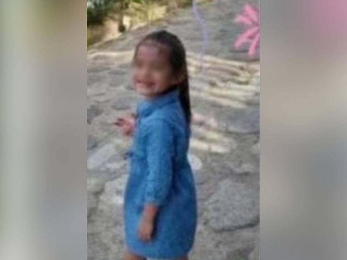 Tenía el cerebro inflamado: Eylin Serrano murió cinco días después tras un accidente en Omoa