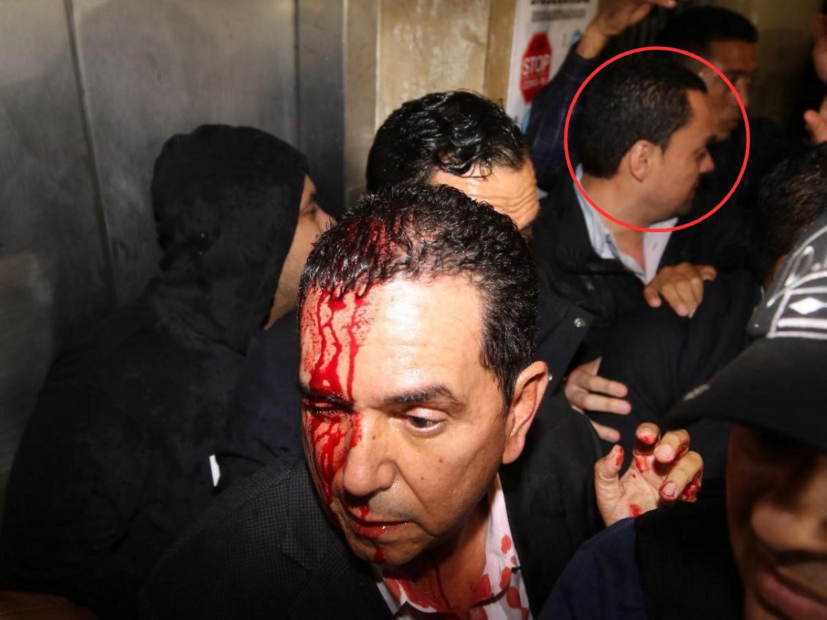 ¿Para quién iba dirigido el ataque explosivo que hirió a la diputada Gladis López?