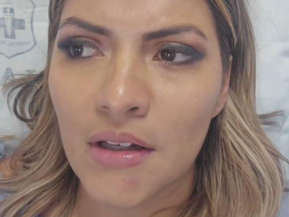 Saraí Espinal, hospitalizada tras sufrir un accidente de tránsito: Me van a suturar el labio Saraí Espinal, hospitalizada tras sufrir un accidente de tránsito: Me van a suturar el labio