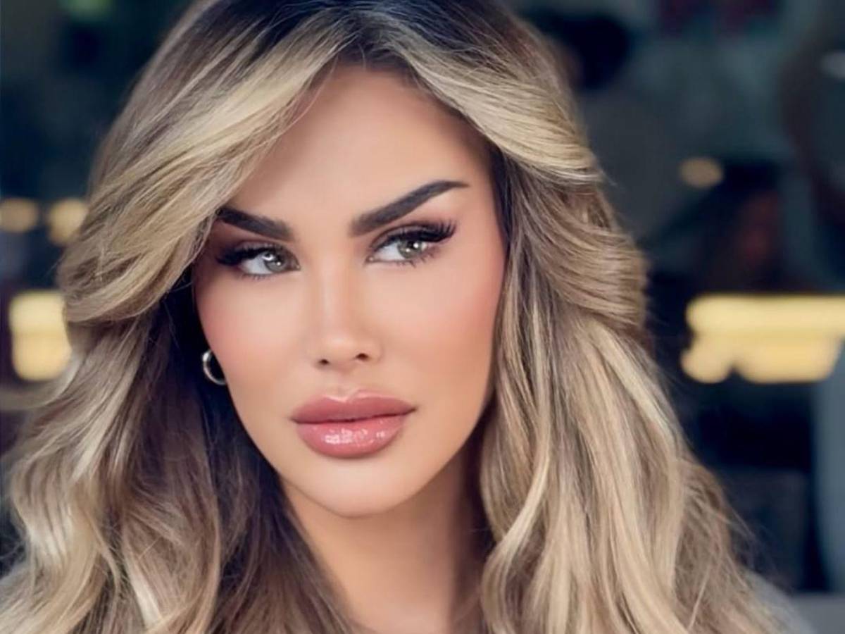 Ninel Conde y el costoso riesgo de la queratopigmentación para tener ojos verdes
