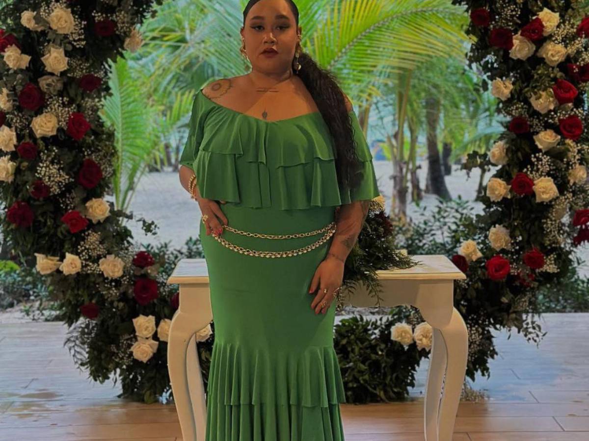 Murió la influencer Xiomara 'La Golda' tras drástica pérdida de peso